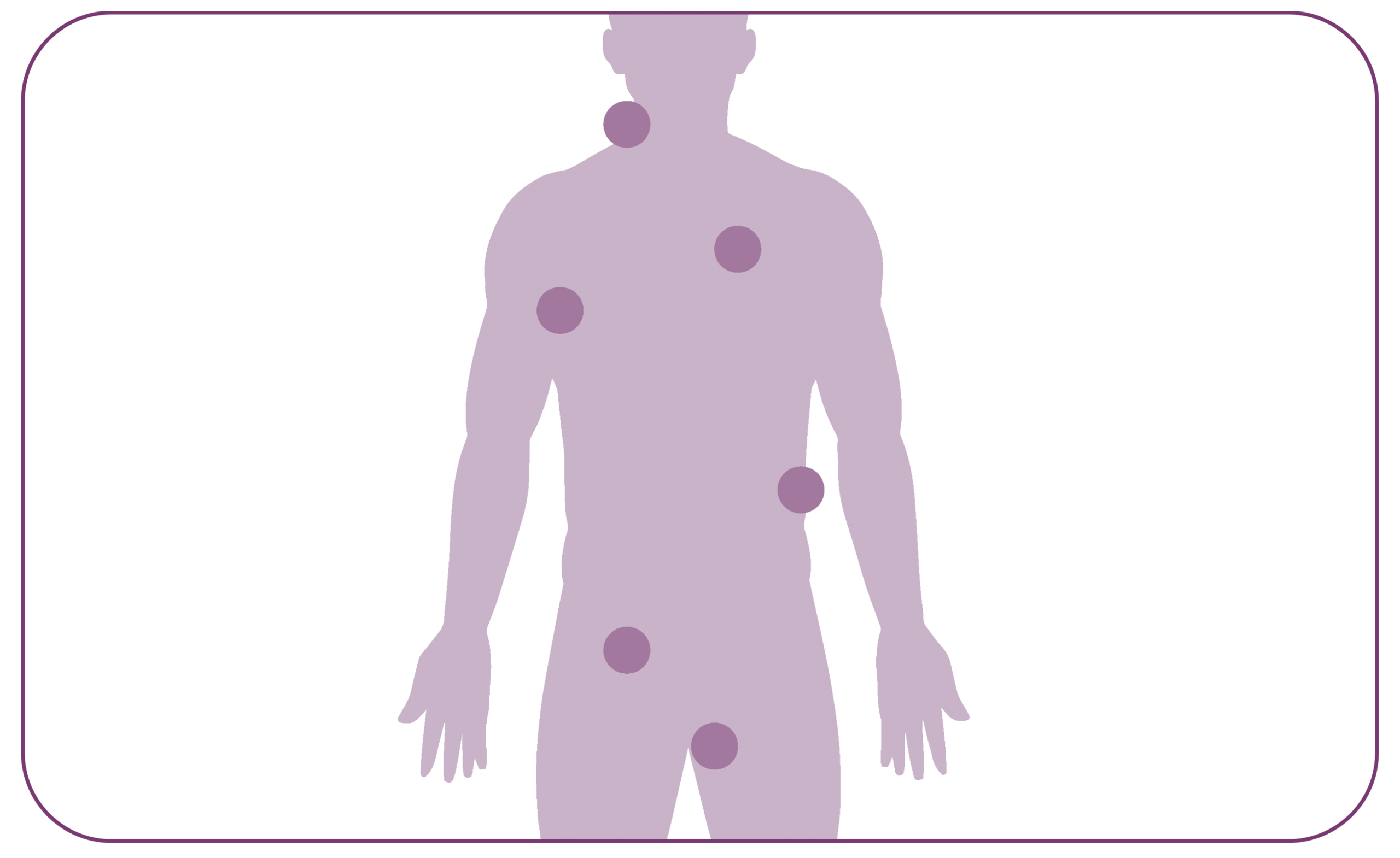 SUR-fibromi-aree